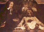 Rembrandt - Peintures - Leçon d'anatomie du Dr Daymen (fragment)